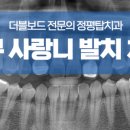 수성사랑니치과의원 이미지