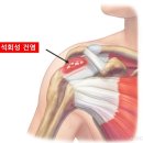신세계정형외과의원 | 석회로 인한 어깨통증, 충격파 이후 부산 수영구 정형외과 도수치료로 가동범위까지 마무리!