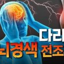 말초동맥폐쇄증 혈전 동맥경화 원인 증상 치료 예방 이미지