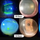 연세바른안과의원 이미지