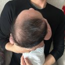 주식회사 한헬스케어 판교센터 | 6개월 아기 사두단두 두상교정헬멧 하니헬멧판교점 후기(한헬스케어 전지점) 무조건 할인(추천인)