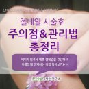 아이니네일 이미지