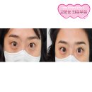 눈매에 맞는 의정부 디자인 속눈썹 연장하는 고운눈 의정부점