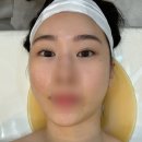 서현)피부관리 안녕,피부에너지테라피 관리 받은솔직후기