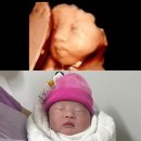예일병원 | 평택 예일 산부인과 제왕절개 1인실 후기 .. 😷