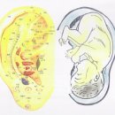 이혈요법 이미지