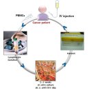 항암면역세포치료의 기전과 이뮨셀의 개요 이미지