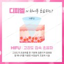 디피엘 이미지