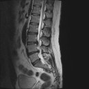 엠알아이 이미지