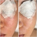 에스와이인주3공장 | 분당 서현피부관리 추천 에스와이뷰티크 분당서현점 홍조 예민 피부관리