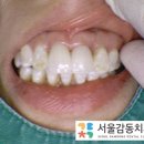 신원치과기공소 이미지