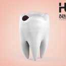 허브치과의원 | 아산 보철치료 치과에서 안내드리는 충치 방치 시, 삭제량이 점점 커질 수밖에 없는 이유