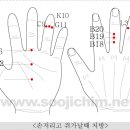 손가락이 저릴때(펌) 이미지