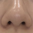 미광정비 | 수원피부관리 프롬미 광교점 블랙헤드관리 블랙모찌 바이오힐 후기