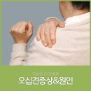 광교 오십견 회전이 넓은 부위이기에 주의해야만 이미지