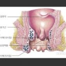 한상준항외과의원 | 치질.치루.수술.근본술후기