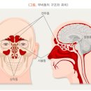 축농증은 무엇인가 이미지