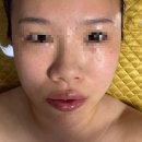 리자스킨엔바디(수성점) | [대구 수성구 신부관리] 리자스킨엔바디 수성점 작은얼굴관리, 웨딩케어 후기