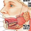 침샘부음 침샘비대증, 침샘염 (턱부음, 턱밑 멍울, 몽우리, 턱통증) 이미지