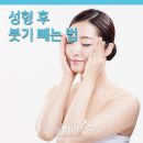 압구정화이트약국 네이버블로그