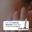 티에스메디칼 네이버블로그