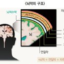 세균성뇌수막염 증상과 검사방법 이미지