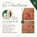 라시뎀 AC-W(에이씨 더블유)앰플 스피큘 모공 트러블 관리 고객님리뷰