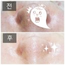 일산피부관리 숲칼프일산점에서 V라인 동안관리 받은 후기