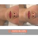 뉴블커피 | 대구신부관리 잘하는곳, 동성로피부관리 받고 온 솔직후기