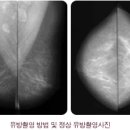대한유방검진의학회