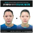 광주기물 - 서구 천변좌로 210 | 광주신부관리 추천 촬영과 본식 일정에 맞춘 고운빛깔 에스테틱 광주점 솔직 후기