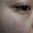메르베유 | ✨세멘잘라이트크림 내돈내산 리얼후기 ✨
