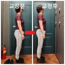 수지 체형관리