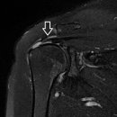 날개병원 이미지