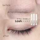 래쉬걸