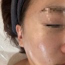 진흥비쥬아르주 | 태안 피부관리 아르에스테틱 내돈내산 왕솔직후기