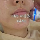 시너지케어메디스 | 의정부 여드름관리 잘하는 희온뷰티 세번째 방문 찐 후기