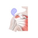 신당청구역마취통증의학과의원 | #어깨통증 석회화건염 치료 잘하는병원 통증클리닉