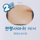 연세클리어의원 | 얼굴 편평사마귀 제거 일주일 후기(내돈내산) / 예비신부 피부관리 - 배곧 연세클리어 의원