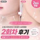 줄투와트 | 관리] 디또뷰티 보라매점 2회차 후기, 얼굴 크기 타고나는 줄 알았는데 (ft. 투턱 실종, 슈디바 리프팅)