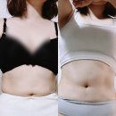 순에스테틱 피부미용