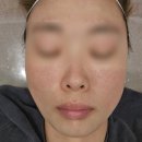 은별이네 | 원주피부관리 원주에스테틱 원주학성동피부관리 은별뷰티 아카데미에서 받은 피부 변화 솔직 후기