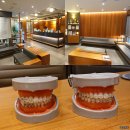 인애치과의원 | 압구정역교정치과 MTA 교정 알아보고 왔어요