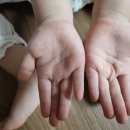 함양웰소아청소년과의원 | 경남 함양)) 소아병원 - 함양웰소아과청소년과의원