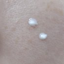 부천하나이비인후과의원 | [부천/피부] 부천 타임의원 레이저 시술 후기 : 흑자, 기미, 점