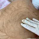 산호메디컬 이미지