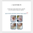 제니스메디칼 네이버블로그