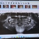 더다나을치과의원 | 우리원헬스케어 치과치료 내돈내산 솔직후기 (레진치료 비용/ 스케일링)