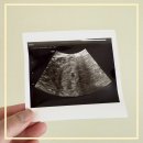 단원보건소 화장실(1층) | 임신초기검사 노원구 보건소에서 검진: 산부인과 산전검사 금액 가격 후기