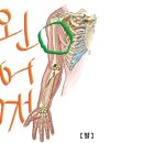 왼어깨 삼두박근 언저리 통증 이미지